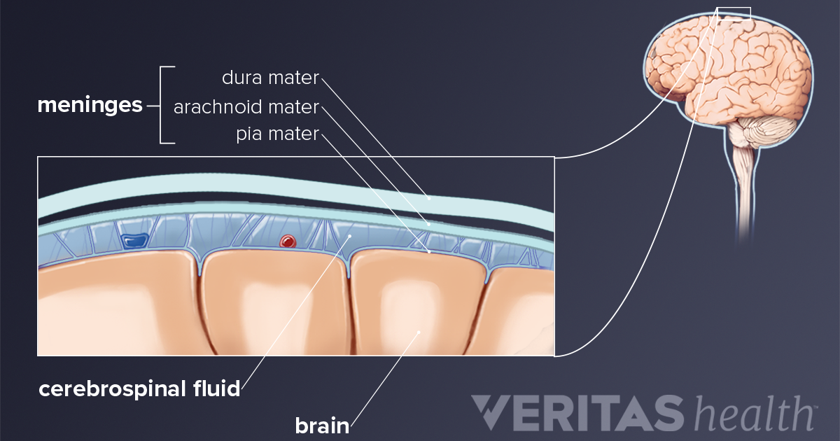 how-meningitis-causes-neck-pain-and-stiffness